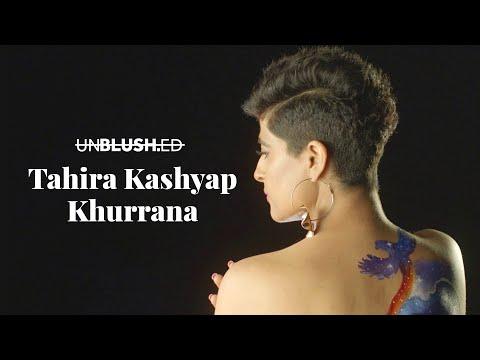 #Birthmarks | Short Film of the Day